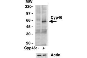 Western analysis of CYP46A1 in HEK293 cells overexpressing CYP46A1 or transfected with an empty vector using CYP46A1 polyclonal antibody . (CYP46A1 抗体)