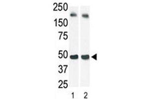 The SphK1 antibody used in western blot (lane 2) to detect c-myc-tagged SphK1 in transfected 293 cell lysate (a c-myc antibody is used as control in Lane 1). (SPHK1 抗体  (AA 1-30))
