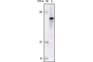 Western Blotting (WB) image for anti-Feline Sarcoma Oncogene (FES) (truncated) antibody (ABIN2464051)
