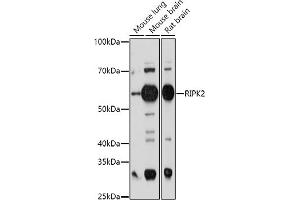 Western blot analysis of extracts of various cell lines, using RIPK2 antibody (ABIN3023312, ABIN3023313, ABIN3023314 and ABIN6219574) at 1:1000 dilution. (RIPK2 抗体  (AA 1-540))