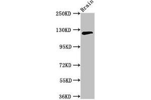 Western Blot Positive WB detected in: Mouse brain tissue All lanes: MYRF antibody at 3. (Chromosome 11open Reading Frame 9 (C11orf9) (AA 843-1004) 抗体)