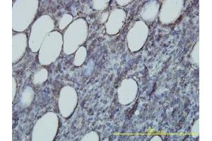 Image no. 1 for anti-RAP2B, Member of RAS Oncogene Family (RAP2B) (AA 1-184) antibody (ABIN598571) (RAP2B 抗体  (AA 1-184))