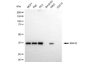 Western blotting analysis using RNF32 antibody (ABIN7800251).