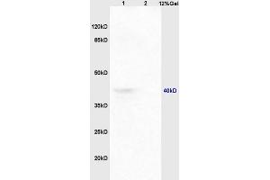 Lane 1: mouse embryo lysates Lane 2: mouse spleen lysates probed with Anti CCR9 Polyclonal Antibody, Unconjugated at 1:200 in 4 ˚C. (CCR9 抗体  (AA 65-160))