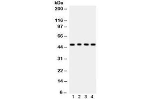Western blot testing of 1) rat lung, 2) rat kidney, 3) human COLO320 and 4) MCF7 lysate with CTBP1 antibody. (CTBP1 抗体)