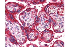 Immunohistochemistry (IHC) image for anti-Wingless-Type MMTV Integration Site Family, Member 3A (WNT3A) (AA 227-276) antibody (ABIN6747200)