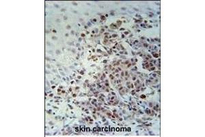 Immunohistochemistry (Paraffin-embedded Sections) (IHC (p)) image for anti-X-Ray Repair Complementing Defective Repair in Chinese Hamster Cells 1 (XRCC1) (AA 407-435) antibody (ABIN651735)