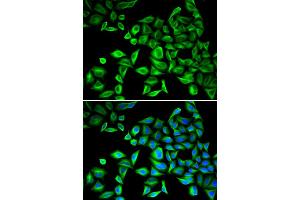 Immunofluorescence analysis of HeLa cells using CRP antibody (ABIN5970054). (CRP 抗体)
