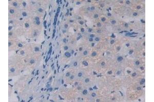 Detection of APOA5 in Human Liver Tissue using Polyclonal Antibody to Apolipoprotein A5 (APOA5) (APOA5 抗体  (AA 167-335))