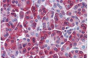 Immunohistochemistry (Formalin-fixed Paraffin-embedded Sections) (IHC (fp)) image for anti-Sequestosome 1 (SQSTM1) (AA 323-372) antibody (ABIN768977)