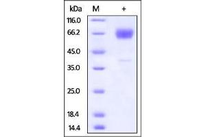 Mouse TIM-3, Fc Tag on SDS-PAGE under reducing (R) condition. (TIM3 Protein (AA 20-191) (Fc Tag))