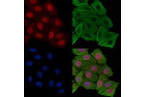 ABIN7093247 and ABIN7097264 staining H2O2 treated Hela cells by IF/ICC.