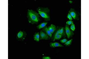 Immunofluorescence staining of A549 cells with ABIN7144485 at 1:166, counter-stained with DAPI.