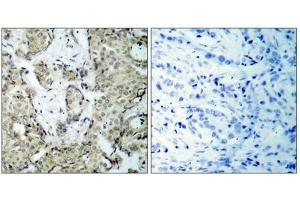 Immunohistochemistry (IHC) image for anti-Mitogen-Activated Protein Kinase Kinase 3 (MAP2K3) (pSer189) antibody (ABIN7138459)