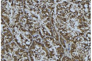 ABIN6268857 at 1/100 staining Mouse testis tissue by IHC-P. (CRHR1 抗体  (Internal Region))