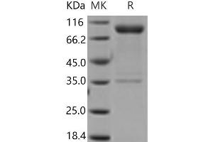 Western Blotting (WB) image for Interleukin 1 Receptor, Type I (IL1R1) (Active) protein (His tag,Fc Tag) (ABIN7321236) (IL1R1 Protein (His tag,Fc Tag))