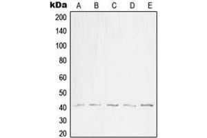 Western blot analysis of WNT1 expression in HEK293T (A), SP2/0 (B), H9C2 (C), WI38 (D), NIH3T3 (E) whole cell lysates. (WNT1 抗体  (C-Term))