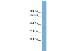 WB Suggested Anti-MFSD8 Antibody Titration: 0. (MFSD8 抗体  (Middle Region))