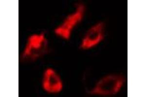 Immunofluorescence (fixed cells) (IF/ICC) image for anti-Cytochrome P450, Family 21, Subfamily A, Polypeptide 2 (CYP21A2) (Internal Region) antibody (ABIN6256952)