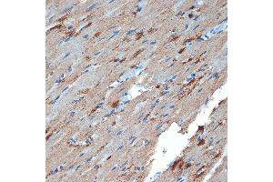 Immunohistochemistry of paraffin-embedded rat heart using Creatine kinase B type (CKB) Rabbit mAb (ABIN7266515) at dilution of 1:100 (40x lens). (CKB 抗体)