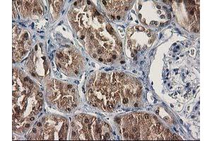 Immunohistochemical staining of paraffin-embedded Human Kidney tissue using anti-SULT1C2 mouse monoclonal antibody. (SULT1C2 抗体)