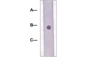 Dot Blot : 1 ug peptide was blot onto NC membrane. (LRP6 抗体  (pThr1479))