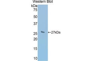 Western blot analysis of the recombinant protein. (IL2 Receptor beta 抗体  (AA 27-240))