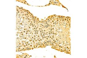 Immunohistochemistry of paraffin embedded rat testis using HOXC9 (ABIN7074251) at dilution of 1:700 (300x lens) (HOXC9 抗体)