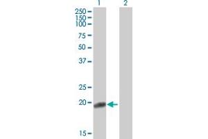 Western Blot analysis of FN1 expression in transfected 293T cell line by FN1 MaxPab polyclonal antibody.