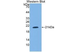 Western blot analysis of the recombinant protein. (SNRPC 抗体  (AA 2-159))