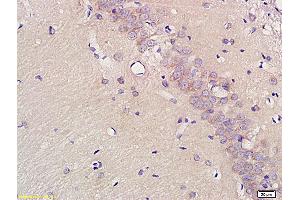 Immunohistochemistry (IHC) image for anti-Solute Carrier Family 1 (Glial High Affinity Glutamate Transporter), Member 2 (SLC1A2) (AA 101-200) antibody (ABIN733928)