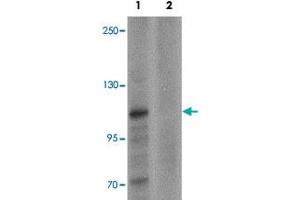 Western blot analysis of ZMIZ1 in K-562 cell lysate with ZMIZ1 polyclonal antibody  at 0.