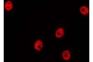 ABIN6269353 staining Hela by IF/ICC. (HDAC1 抗体  (C-Term))