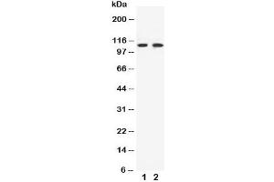 Western blot testing of EphB3 antibody and Lane 1:  HeLa (EPH Receptor B3 抗体  (C-Term))