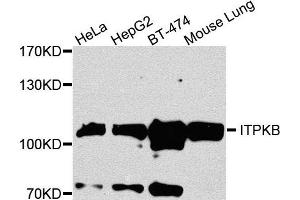 Western blot analysis of extracts of various cells, using ITPKB antibody. (ITPKB 抗体)