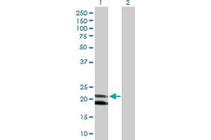 Western Blot analysis of IFNA4 expression in transfected 293T cell line by IFNA4 MaxPab polyclonal antibody. (IFNA4 抗体  (AA 1-189))