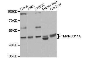 Western blot analysis of extracts of various cell lines, using TMPRSS11A antibody (ABIN5995991) at 1/1000 dilution. (TMPRSS11A 抗体)