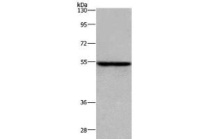Western Blot analysis of MCF-7 cell using ETS2 Polyclonal Antibody at dilution of 1:300 (ETS2 抗体)