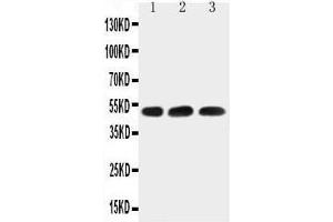 Anti-HYAL1 antibody,  Western blotting Lane 1: HELA Cell Lysate Lane 2: 22RV1 Cell Lysate Lane 3: MCF-7 Cell Lysate (HYAL1 抗体  (N-Term))