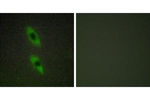 Peptide - +Immunohistochemistry analysis of paraffin-embedded human liver carcinoma tissue using FADD antibody. (FADD 抗体)