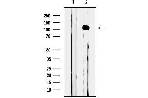 Western blot analysis of lysates from Jurkat cells, using MICAL1 Antibody.