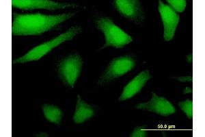 Immunofluorescence of monoclonal antibody to DDX43 on HeLa cell. (DDX43 抗体  (AA 2-90))