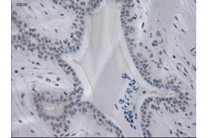Immunohistochemical staining of paraffin-embedded breast using anti-IL-3 (ABIN2452543) mouse monoclonal antibody. (IL-3 抗体  (AA 20-152))