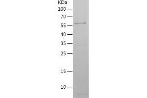 Western Blotting (WB) image for Annexin A5 (ANXA5) (AA 1-319) protein (His-EGFP Tag) (ABIN7283183) (Annexin V Protein (AA 1-319) (His-EGFP Tag))