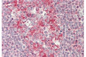 Rabbit Anti-RAPGEF1 antibody Catalog Number: ARP54753 Formalin Fixed Paraffin Embedded Tissue: Human Tonsil Primary antibody Concentration: 1:100 Secondary Antibody: Donkey anti-Rabbit-Cy3 Secondary Antibody Concentration: 1:200 Magnification: 20x Exposure Time: 0. (GRF2 抗体  (C-Term))