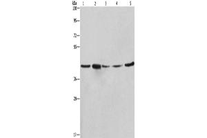 Western Blotting (WB) image for anti-Ribosomal Protein SA (RPSA) antibody (ABIN2421848) (RPSA/Laminin Receptor 抗体)
