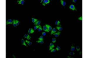 Immunofluorescence staining of Hela cells with ABIN7154731 at 1:133, counter-stained with DAPI. (GNA12 抗体  (AA 112-270))
