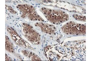 Immunohistochemical staining of paraffin-embedded Human Kidney tissue using anti-FBXO21 mouse monoclonal antibody. (FBXO21 抗体)
