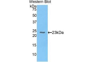 Detection of Recombinant CBX3, Human using Polyclonal Antibody to Chromobox Homolog 3 (CBX3) (CBX3 抗体  (AA 1-183))