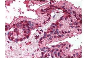 Image no. 1 for anti-Tumor Necrosis Factor Receptor Superfamily, Member 19 (TNFRSF19) (AA 29-44) antibody (ABIN372452)